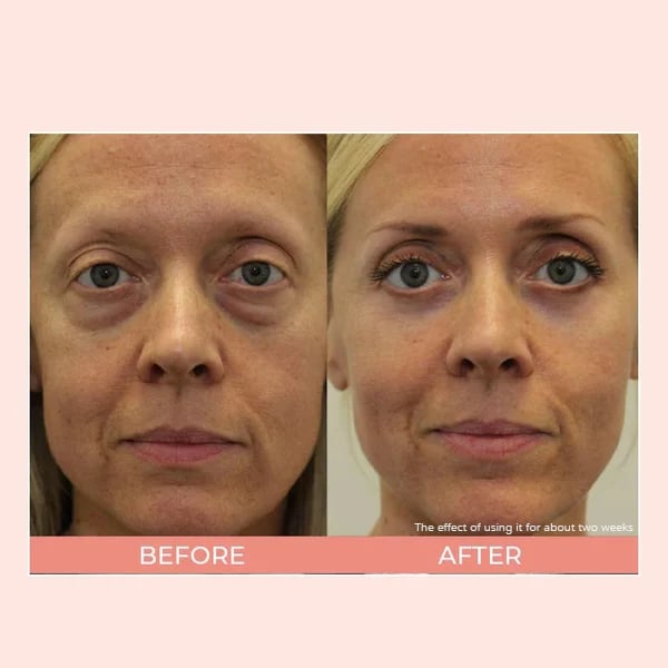š
Xmas Hot Sales NEW! āØUnder Eye Color Corrector for Dark Circles
