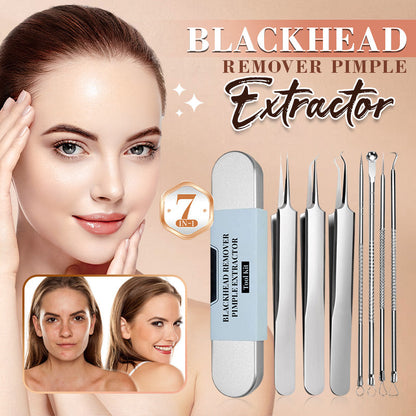 Stainless Steel Blackhead Remover Tool Kit