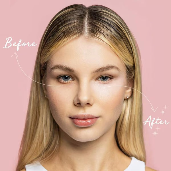 ✨ LAST DAY PROMOTION - BUY 1 GET 1 FREE✨Under Eye Brightener, Conceal & Brighten Dark Circles