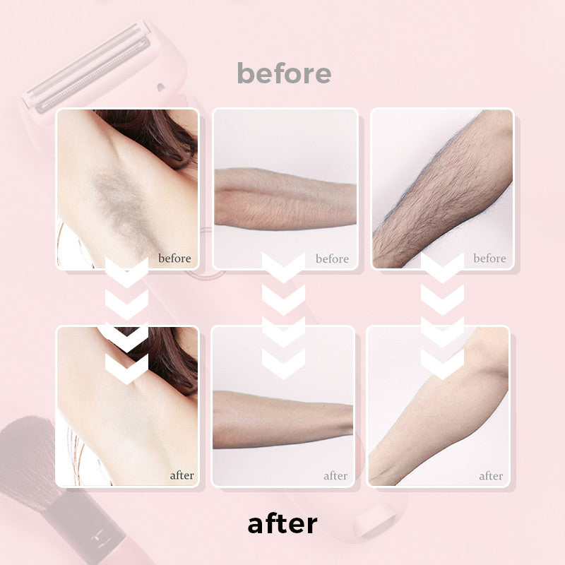 🔥 New Year Sale 60% OFF💝Multifunctional shaver for women✨